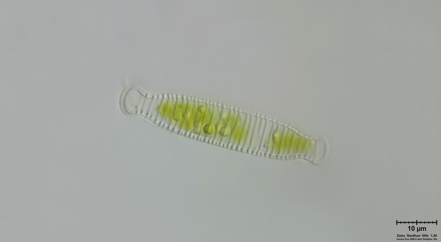 Diatoma vulgaris - vista valvare